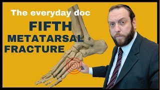 5th Metatarsal Fracture with audio descriptions [upl. by Schreib62]