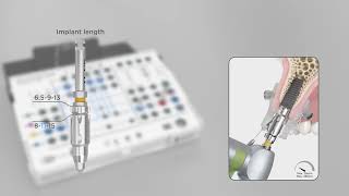 DS Primetaper GS Tray set up and workflow animation [upl. by Sonitnatsnoc197]