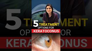 5 Treatment Options For Keratoconus [upl. by Dosi]