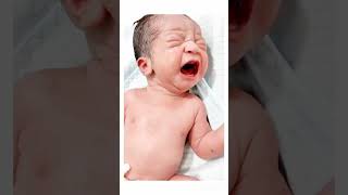 Neonatal baby admit in nicubaby nicu doctor subscribemychannel 🙏hospital 🏥🏥 [upl. by Avilys]