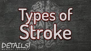 Types of Ischaemic Stroke  Oxford Bamford Classification  Details [upl. by Daniel]