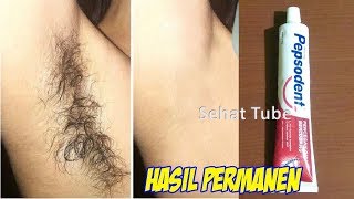 HANYA 5 MENIT BEGINI CARA MERONTOKKAN BULU KET IAK SECARA PERMANEN DENGAN PASTA GIGI  SEHAT TUBE [upl. by Eirhtug]