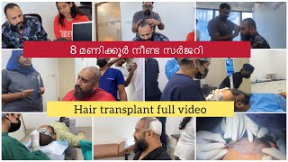 Hair Transplant Journey  La Densitae  Arjun Somasekhar  Sowbhagya Venkitesh [upl. by Nabroc635]