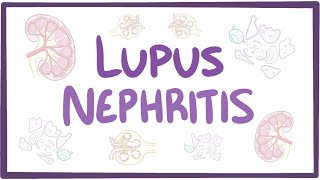 Lupus nephritis  causes symptoms diagnosis treatment pathology [upl. by Michaela]