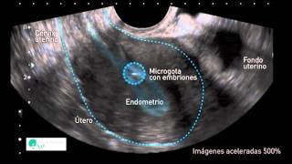 INSTITUT MARQUÈS  El útero mueve a los embriones para que se implanten correctamente [upl. by Blasius]