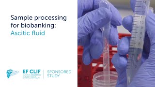 Sample processing for biobanking Ascitic fluid [upl. by Faxan]