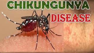 chikungunya  clinical and laboratory features of Chikungunya compared with Dengue fever [upl. by Leugimsiul]