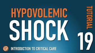 Hypovolemic Shock [upl. by Yemirej]