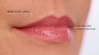 Fillerina Specific Zones with 3D Collagen [upl. by Erual]