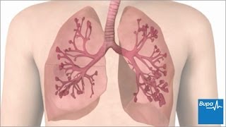 How an asthma attack occurs  Bupa Health [upl. by Yelir561]