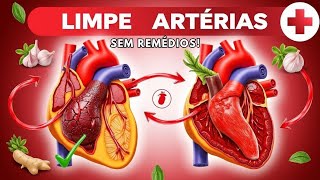 LIMPE AS ARTÉRIAS ENTUPIDAS NATURALMENTE SEM REMÉDIOS E SEM CIRURGIA [upl. by Azral]