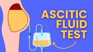 Ascitic Fluid Test  Peritoneal Fluid Collection Examination amp Analysis Explained [upl. by Hennie]