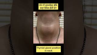 Position of thyroid gland in neck [upl. by Shah]