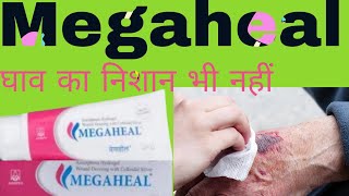 Megaheal ointment Uses in Hindi  मेगाहील क्रीम के बारे में जानकारी [upl. by Ramor827]