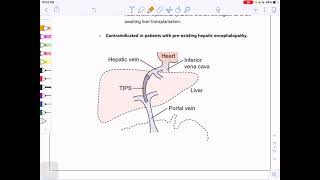 Lecture 5 part 3 Portal Hypertension [upl. by Aicylla]