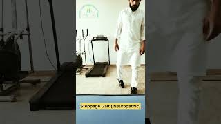 Understanding Steppage Gait What You Need to Know 😍  Physio Cure [upl. by Matthew]