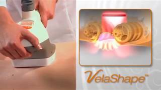 VelaShape  video ENG [upl. by Ovatsug]