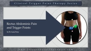 Rectus Abdominis Pain and Trigger Points [upl. by Anaert]