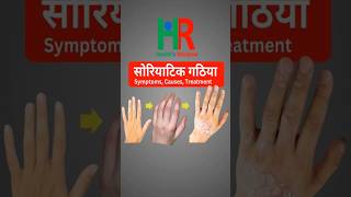 psoriatic arthritis in hindi arthritis psoriasis healthsrainbow [upl. by Lertnek]