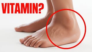 1 Vitamin to Eliminate Swelling in Feet and Legs [upl. by Mahla815]