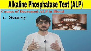 Alkaline Phosphatase Test ALP [upl. by Beffrey]