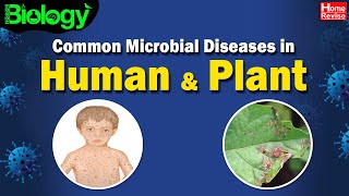 Common Microbial Diseases in Humans amp Plants  Biology  Home Revise [upl. by Llenreb853]