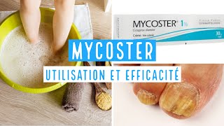 MYCOSTER Ciclopirox 1  8 [upl. by Idner]