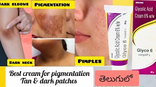 GLYCO 6 Cream review in telugu How to use Glycolic acidGlycolic acid cream [upl. by Chuck]