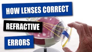 How Opticians Use Lenses To Correct Refractive Errors [upl. by Hsu613]