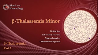 Alpha thalassemia  Beta thalassemia  Thalassemia explained [upl. by Llarret192]