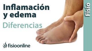 Inflamación y edema  Diferencias y características [upl. by Wallache239]