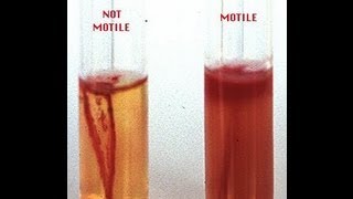 Motility Determination in Bacteria  Amrita University [upl. by Goldberg]