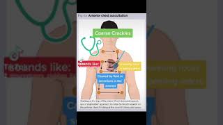 Chest Auscultation Identifying common BreathLung Sounds [upl. by Llerahs376]