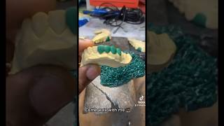 Want to learn how to wax grillz for your grillz business [upl. by Yancey]