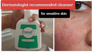 episoft cleansing lotion review in Tamil sensitiveskin [upl. by Jude883]