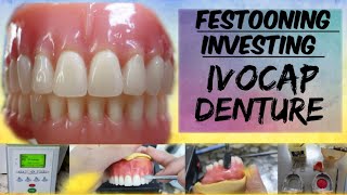 How Complete Upper Denture Processed w Ivocap Materials festooning investing [upl. by Endor]