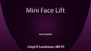 Mini Facelift 3D Video  Dr Landsman [upl. by Sarad529]