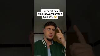 Kinder mit den AUSSERGEWÖHNLICHSTEN Körpern…😳  foryou trending fypシ゚viral trend deutsch fy [upl. by Omlesna135]