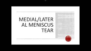 MCL sprain amp Torn meniscus mediallateral [upl. by Wernick]