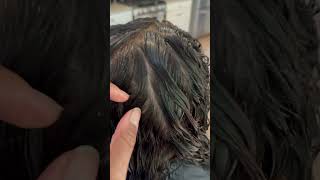 Dandruff l flaky scalp l hair video l treatment [upl. by Swinton]