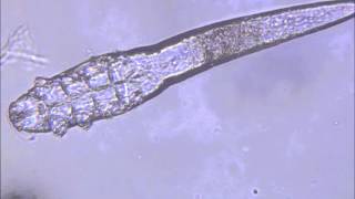 Demodex Mites [upl. by Atiuqrahc]