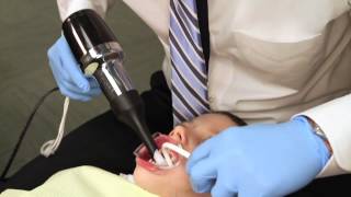 Rapid Palatal Expander Procedure Explained [upl. by Mihe]