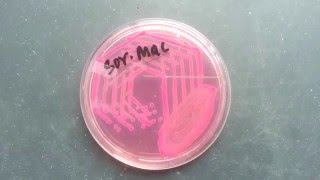 Sorbitol MacConkey agar [upl. by Adle]