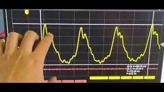 Diagnostico por imagem Osciloscópio  TVA  Spin 18 2016 [upl. by Lyman]