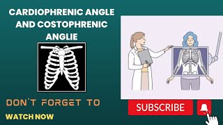 costophrenic and cardiophrenic angle and lungs zone [upl. by Ahseuqram]