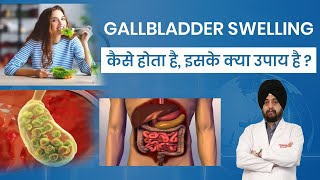 Gallbladder Swelling in Hindi Causes Risks and Treatment Options पित्ताशय में सूजन के कारण इलाज [upl. by Nauqyt]