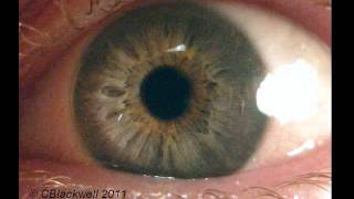 Eye Works 1 Focusing Cornea Iris and Lens [upl. by Audrey639]