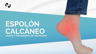 ¿Qué es el Espolón Calcáneo Causas diagnóstico y tratamiento de Fisioterapia [upl. by Shirah850]