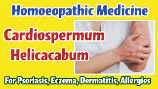 Cardiospermum Helicacabum Homoeopathic Medicine for Psoriasis Eczema Dermatitis Allergies [upl. by Caundra]