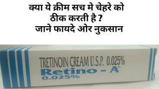 Retinoa Cream 0025 Review In Hindi । Tretinoin Cream [upl. by Dwyer752]